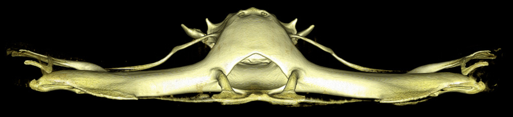 Figure 9.13 B