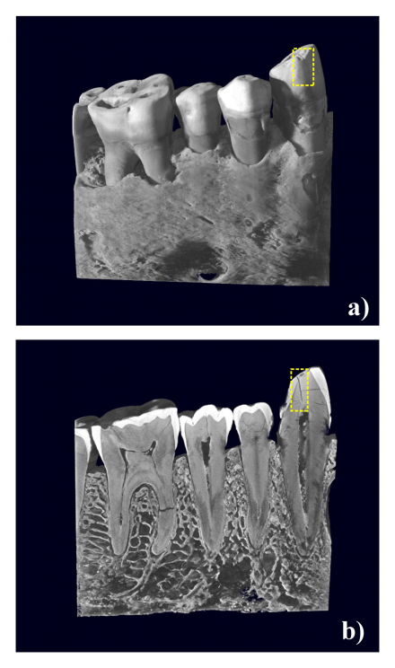 X-ray of the Lonche jaw