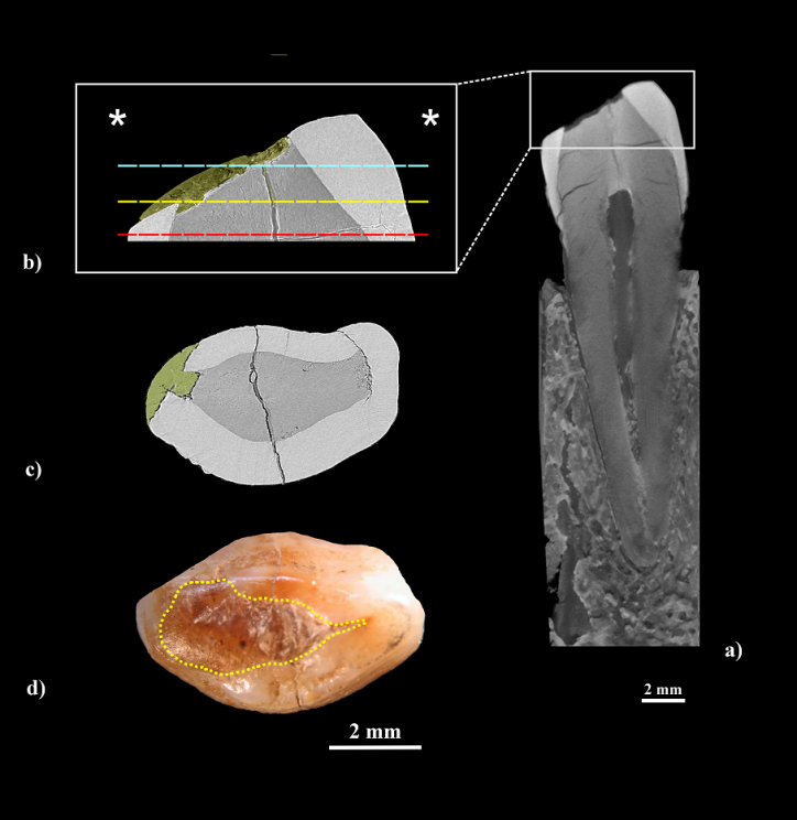 X-ray with synchrotron radiation