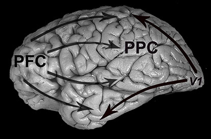 brain