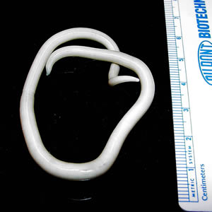 An adult Ascaris lumbricoides worm. CDC Division of Parasitic Diseases. Public domain via Wikimedia Commons.