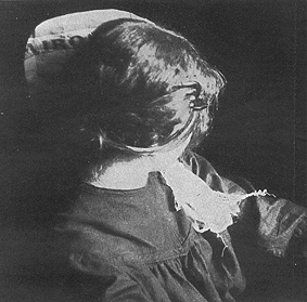 Albert von Schrenck-Notzing, Photograph of Eva C. showing fraud ectoplasm made from a Paris newspaper, Le Miroir. 1912. Public domain via Wikimedia Commons.