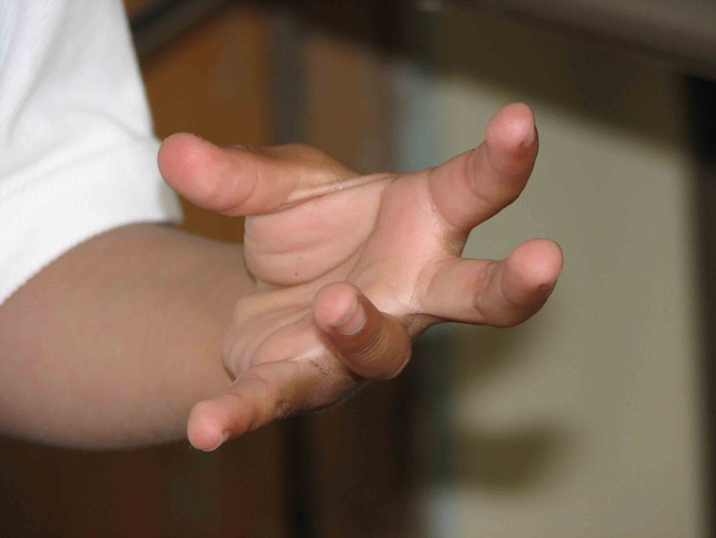 Child attempting test on motor coordination