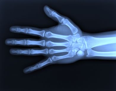 X -ray