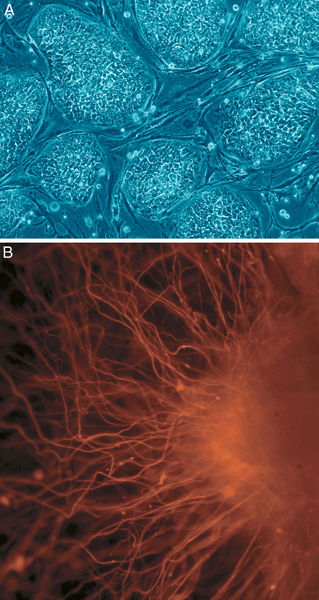 319px-Human_embryonic_stem_cells