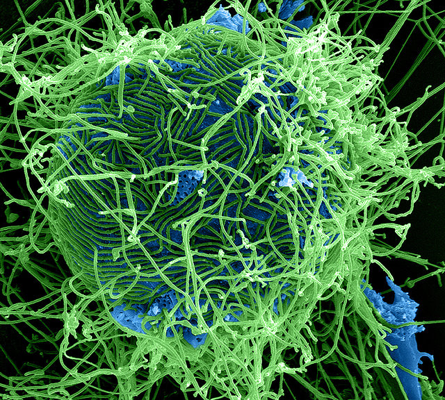 Ebola Virus Particles: Colorized scanning electron micrograph of filamentous Ebola virus particles (green) attached to and budding from a chronically infected VERO E6 cell (blue) (25,000x magnification). Credit: NIAID. CC BY 2.0 via NIAID Flickr. 