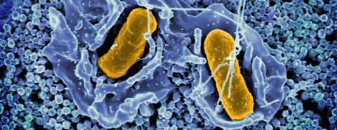 microbes under a microscope